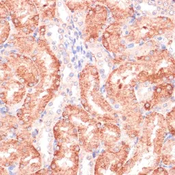 Anti-RPIA antibody used in IHC (Paraffin sections) (IHC-P). GTX66545