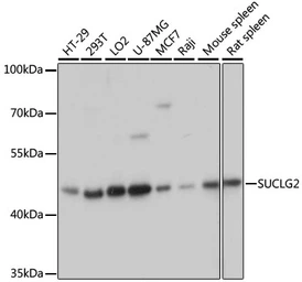Anti-SUCLG2 antibody used in Western Blot (WB). GTX66548