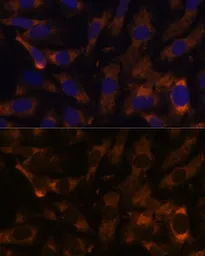 Anti-SUCLG2 antibody used in Immunocytochemistry/ Immunofluorescence (ICC/IF). GTX66548