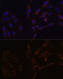 Anti-SUCLG2 antibody used in Immunocytochemistry/ Immunofluorescence (ICC/IF). GTX66548