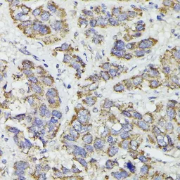 Anti-SUCLG2 antibody used in IHC (Paraffin sections) (IHC-P). GTX66548