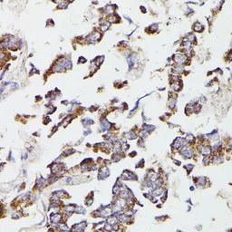 Anti-SUCLG2 antibody used in IHC (Paraffin sections) (IHC-P). GTX66548
