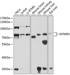 Anti-MTMR2 antibody used in Western Blot (WB). GTX66550