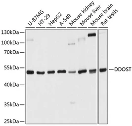 Anti-OST48 antibody used in Western Blot (WB). GTX66551