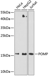 Anti-POMP antibody used in Western Blot (WB). GTX66553
