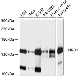 Anti-Nardilysin antibody used in Western Blot (WB). GTX66556