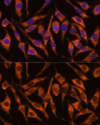 Anti-SNX15 antibody used in Immunocytochemistry/ Immunofluorescence (ICC/IF). GTX66558