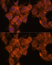 Anti-SNX15 antibody used in Immunocytochemistry/ Immunofluorescence (ICC/IF). GTX66558