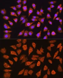 Anti-IMPDH1 antibody used in Immunocytochemistry/ Immunofluorescence (ICC/IF). GTX66572