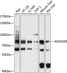 Anti-ADAM28 antibody used in Western Blot (WB). GTX66574