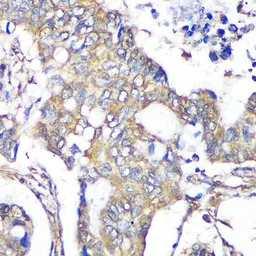 Anti-TXNDC9 antibody used in IHC (Paraffin sections) (IHC-P). GTX66578