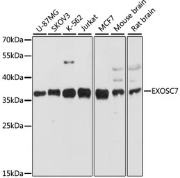 Anti-EXOSC7 antibody used in Western Blot (WB). GTX66579