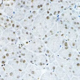 Anti-p66 beta antibody used in IHC (Paraffin sections) (IHC-P). GTX66580