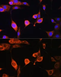 Anti-ATP5D antibody used in Immunocytochemistry/ Immunofluorescence (ICC/IF). GTX66588