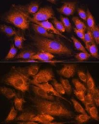 Anti-ATP5D antibody used in Immunocytochemistry/ Immunofluorescence (ICC/IF). GTX66588