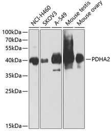 Anti-PDHA2 antibody used in Western Blot (WB). GTX66591