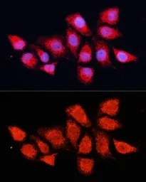 Anti-PDHA2 antibody used in Immunocytochemistry/ Immunofluorescence (ICC/IF). GTX66591