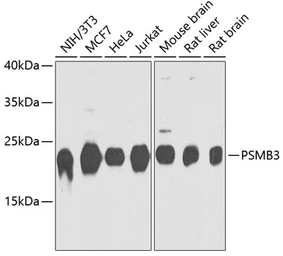 Anti-Proteasome 20S beta 3 antibody used in Western Blot (WB). GTX66592
