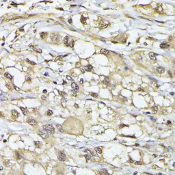Anti-Proteasome 20S beta 3 antibody used in IHC (Paraffin sections) (IHC-P). GTX66592