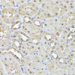 Anti-Proteasome 20S beta 3 antibody used in IHC (Paraffin sections) (IHC-P). GTX66592