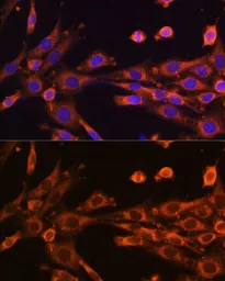 Anti-SUPV3L1 antibody used in Immunocytochemistry/ Immunofluorescence (ICC/IF). GTX66593