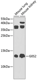 Anti-G0/G1switch 2 antibody used in Western Blot (WB). GTX66594