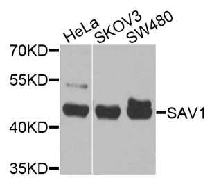 Anti-Salvador homolog 1 antibody used in Western Blot (WB). GTX66596