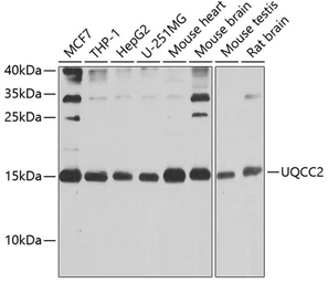 Anti-MNF1 antibody used in Western Blot (WB). GTX66598
