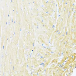 Anti-MNF1 antibody used in IHC (Paraffin sections) (IHC-P). GTX66598