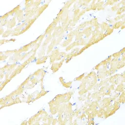 Anti-MNF1 antibody used in IHC (Paraffin sections) (IHC-P). GTX66598