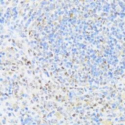 Anti-MNF1 antibody used in IHC (Paraffin sections) (IHC-P). GTX66598