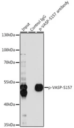 Anti-VASP (phospho Ser157) antibody used in Immunoprecipitation (IP). GTX66601