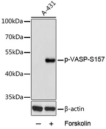 Anti-VASP (phospho Ser157) antibody used in Western Blot (WB). GTX66601