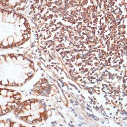 Anti-VASP (phospho Ser157) antibody used in IHC (Paraffin sections) (IHC-P). GTX66601