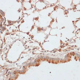 Anti-VASP (phospho Ser157) antibody used in IHC (Paraffin sections) (IHC-P). GTX66601