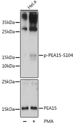 Anti-PEA15 (phospho Ser104) antibody used in Western Blot (WB). GTX66602