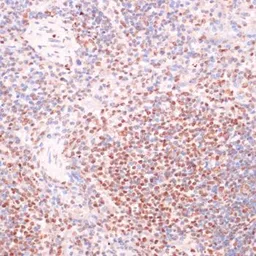 Anti-SRF (phospho Ser103) antibody used in IHC (Paraffin sections) (IHC-P). GTX66603