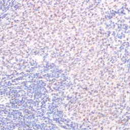 Anti-SRF (phospho Ser103) antibody used in IHC (Paraffin sections) (IHC-P). GTX66603