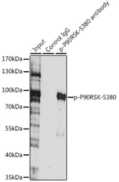Anti-p90 RSK1 (phospho Ser380) antibody used in Immunoprecipitation (IP). GTX66605