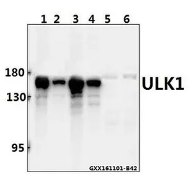 Anti-ULK1 antibody used in Western Blot (WB). GTX66613