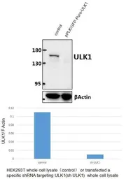 Anti-ULK1 antibody used in Western Blot (WB). GTX66613