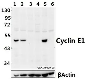 Anti-Cyclin E1 antibody used in Western Blot (WB). GTX66617