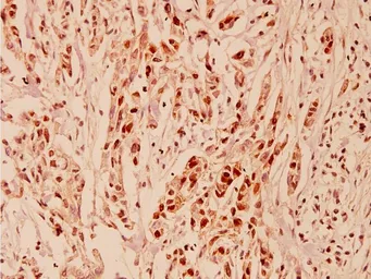 Anti-Cyclin E1 antibody used in IHC (Paraffin sections) (IHC-P). GTX66618