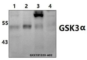 Anti-GSK3 alpha antibody used in Western Blot (WB). GTX66620