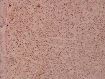 Anti-JunD antibody used in IHC (Paraffin sections) (IHC-P). GTX66621
