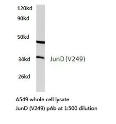Anti-JunD antibody used in Western Blot (WB). GTX66621