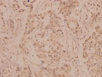 Anti-MMP8 antibody used in IHC (Paraffin sections) (IHC-P). GTX66623