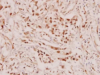 Anti-Retinoic Acid Receptor beta antibody used in IHC (Paraffin sections) (IHC-P). GTX66626