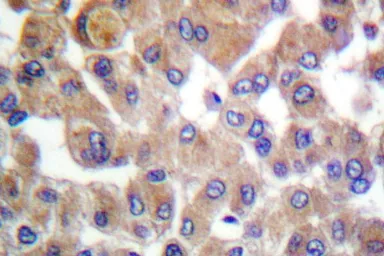 Anti-TGF beta 1 antibody used in IHC (Paraffin sections) (IHC-P). GTX66628