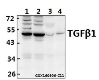Anti-TGF beta 1 antibody used in Western Blot (WB). GTX66628